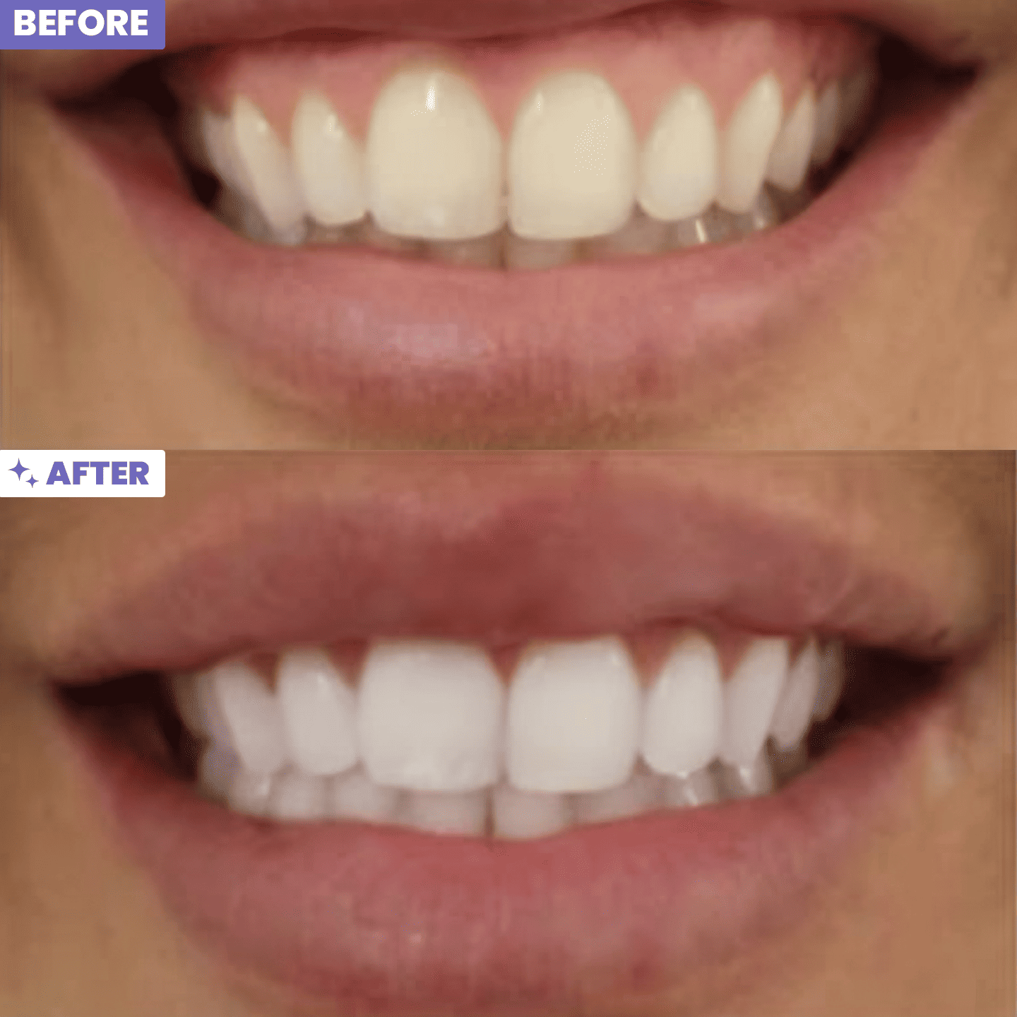 Pandore Whitening Kit™